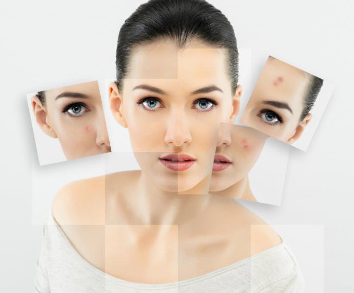 Dermabrasion: ביקורות, דעות, מחירים, מחירים