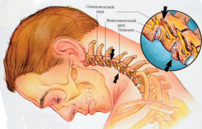 אנטומיה: מבנה הצוואר של גבר באופן כללי